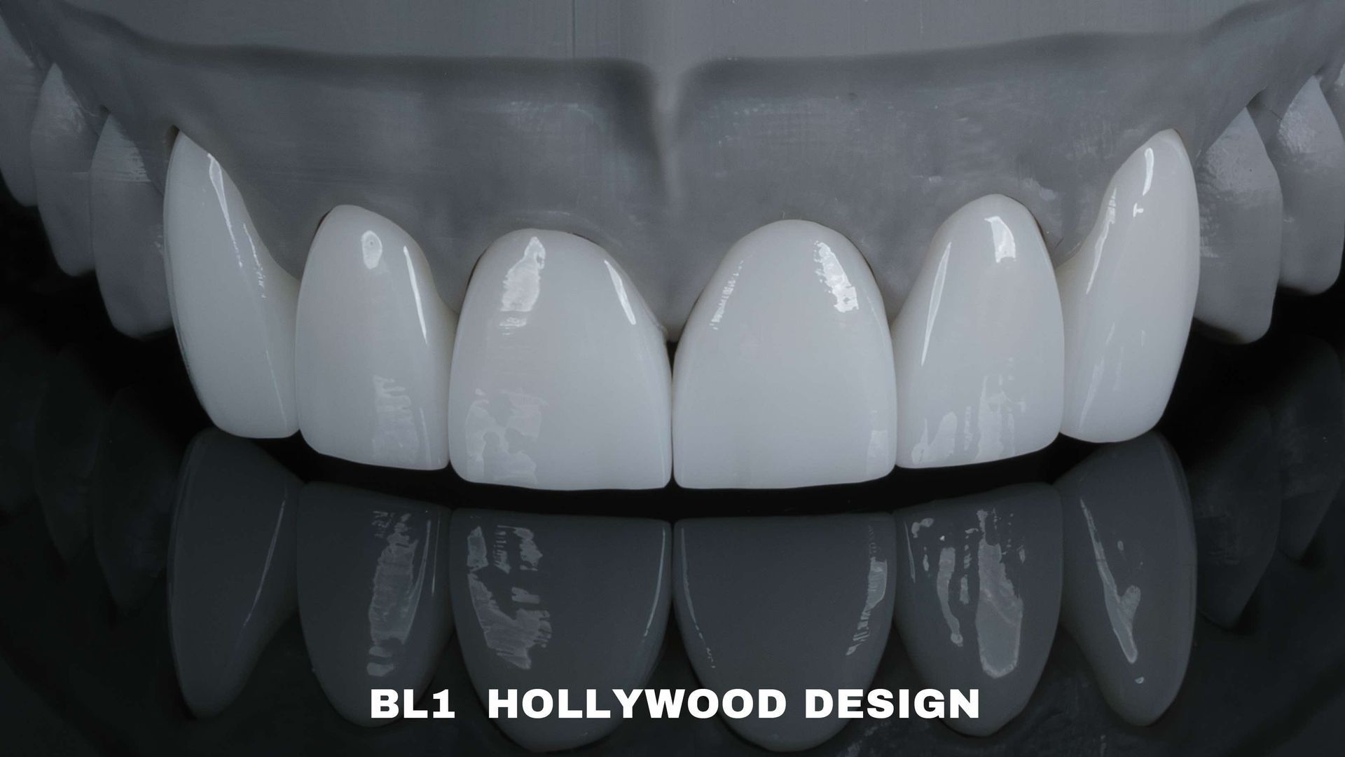 Close-up of a set of bright, white teeth labeled 