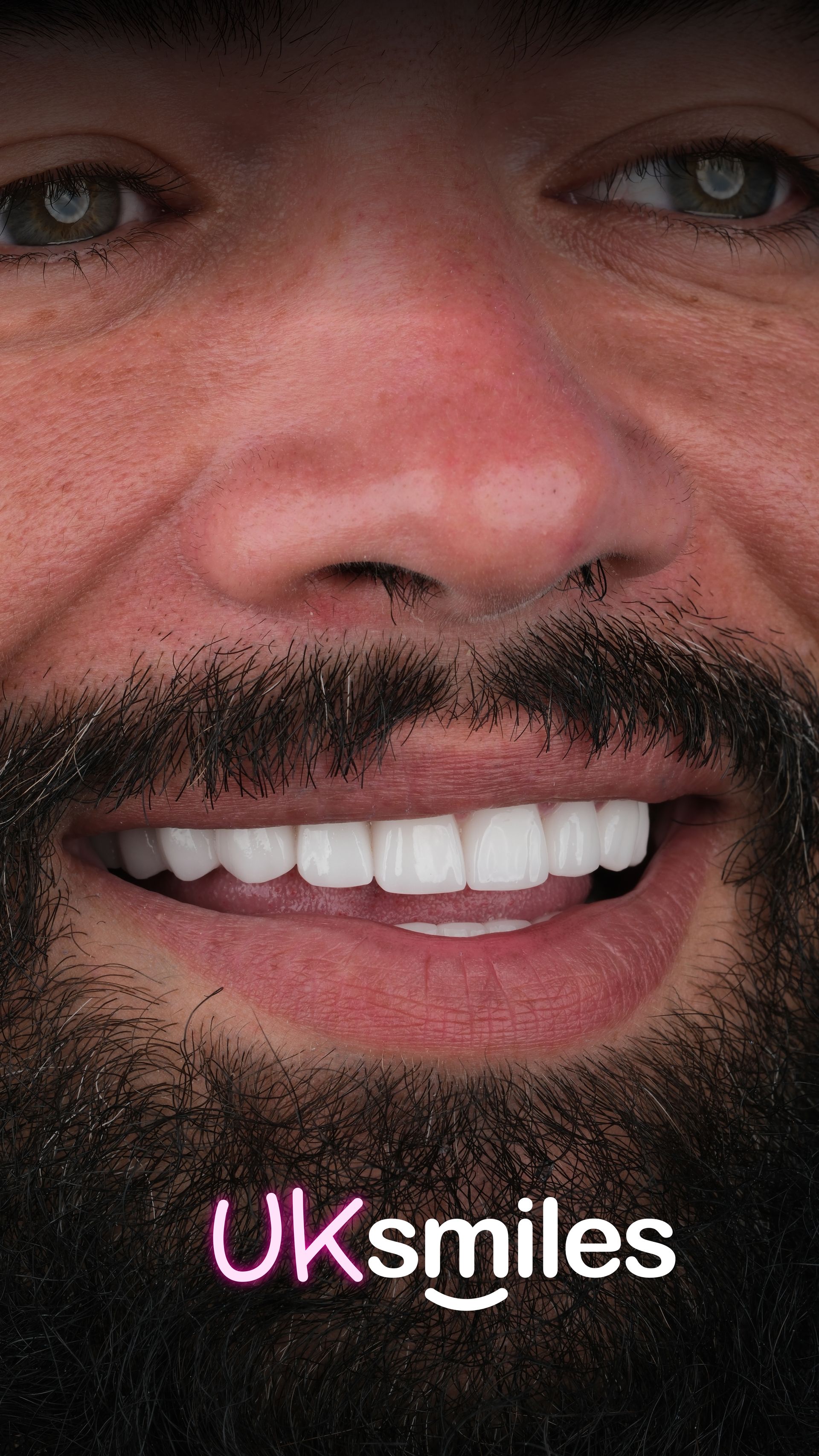 Close-up of a smiling man with perfect white teeth, text