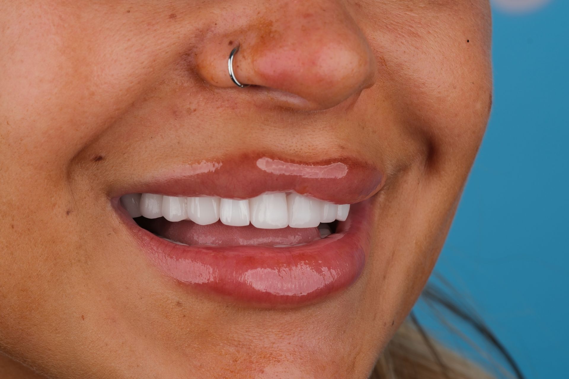 Woman smiling, showing white teeth and shiny, full lips; a nose ring is visible.