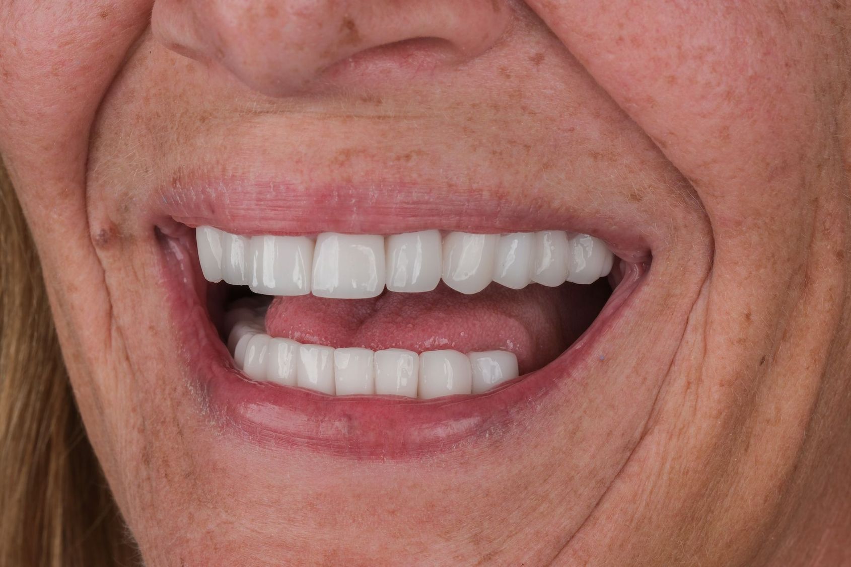 Mouth open showing bright, even teeth; person smiling; light skin and reddish lips.
