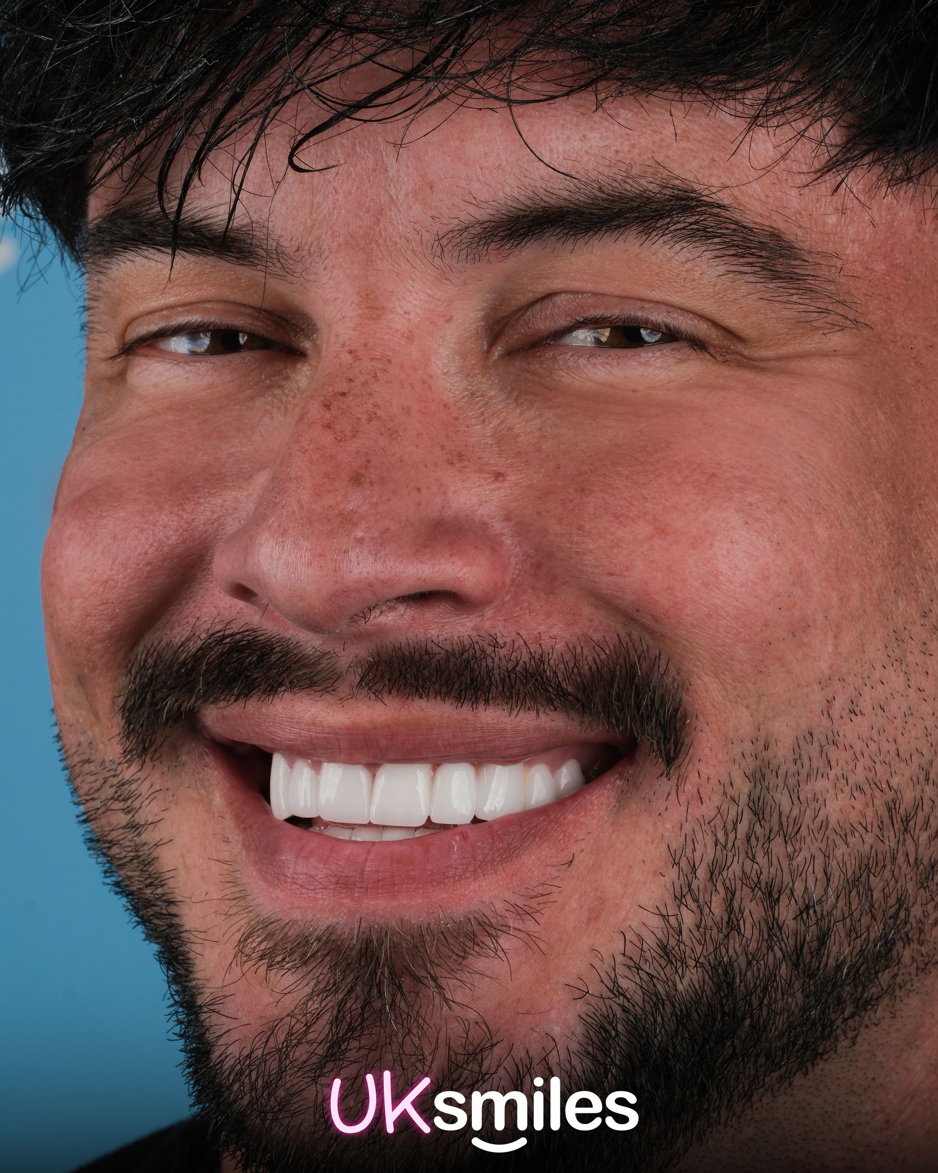Smiling man with white teeth, brown hair, and beard against a light blue background.