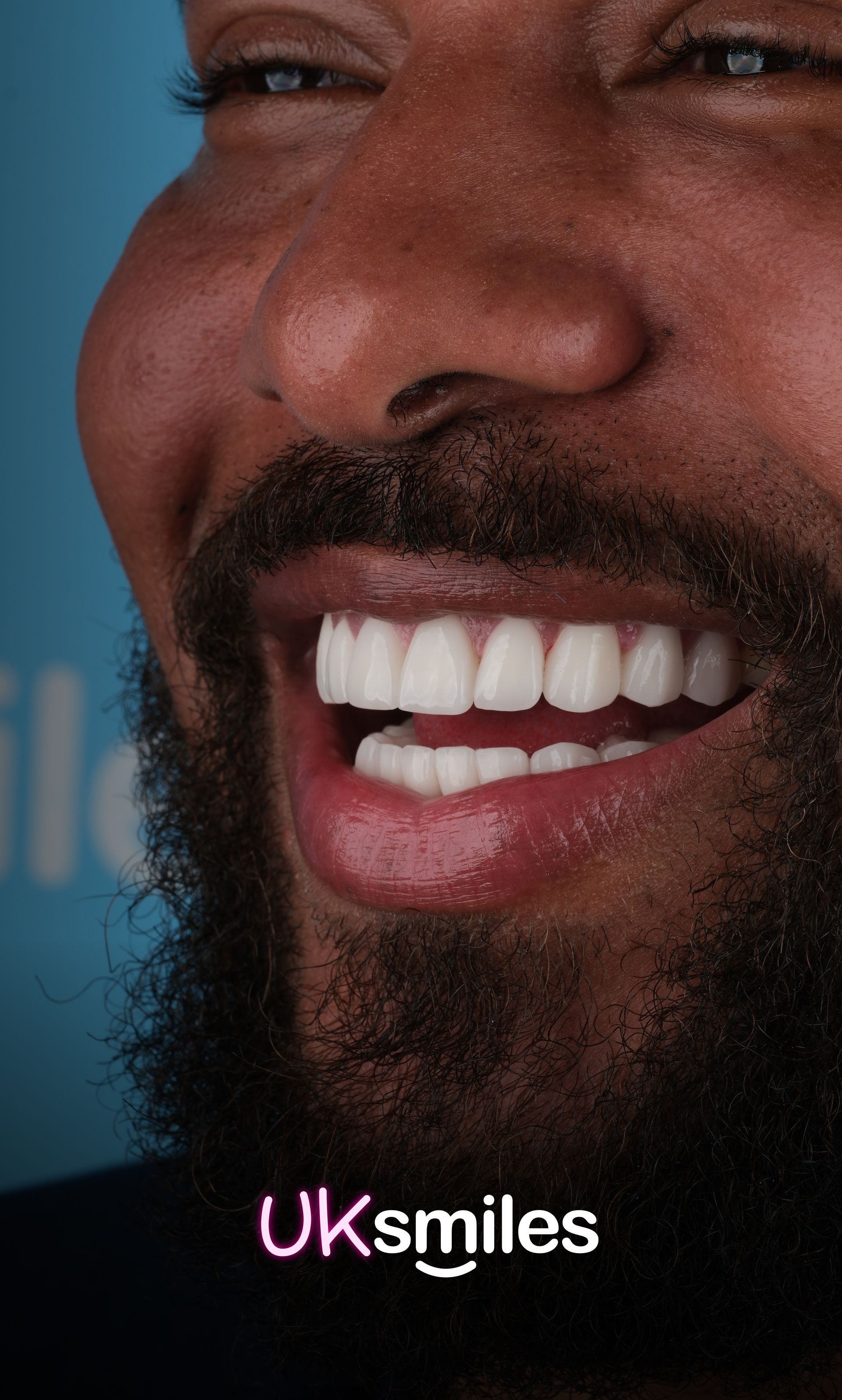 Close-up of a Black man smiling, showing perfect white teeth and a dark beard. UKsmiles logo is visible.