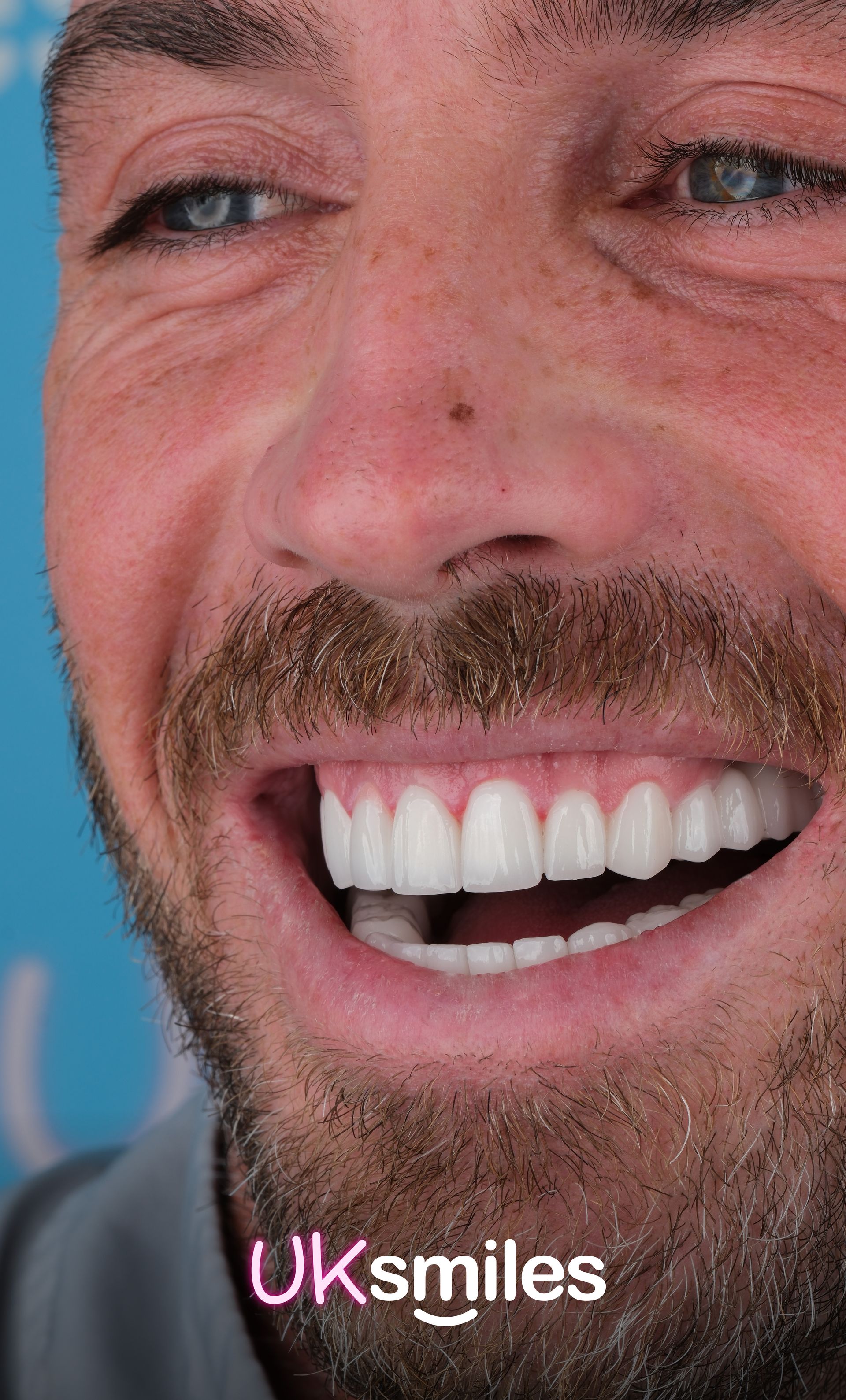 Smiling man with bright white teeth, short beard, blue eyes. UKsmiles logo in corner.