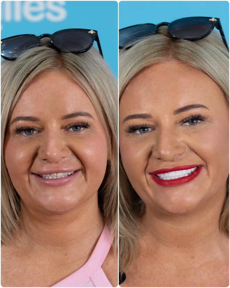 Before and after photos of a woman with blonde hair, smiling with different lip colors and enhanced teeth.