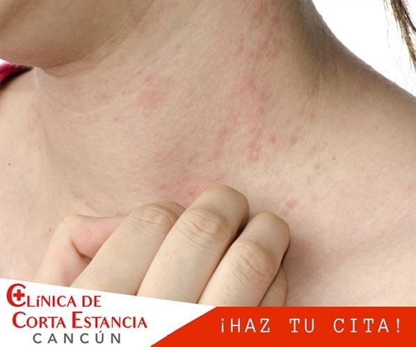 CLÍNICA DE CORTA ESTANCIA CANCÚN