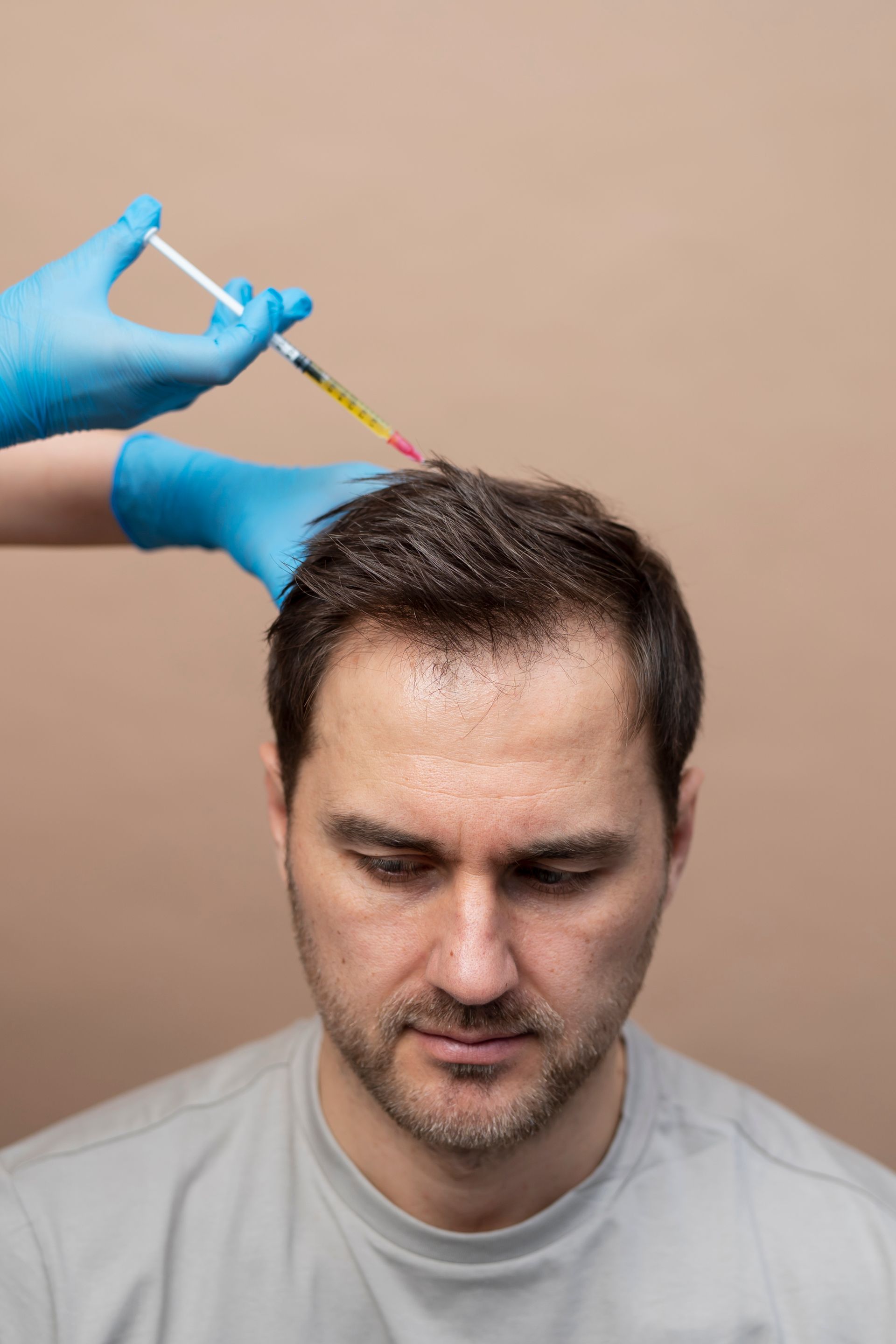 a man is getting a hair transplant injection in his head .