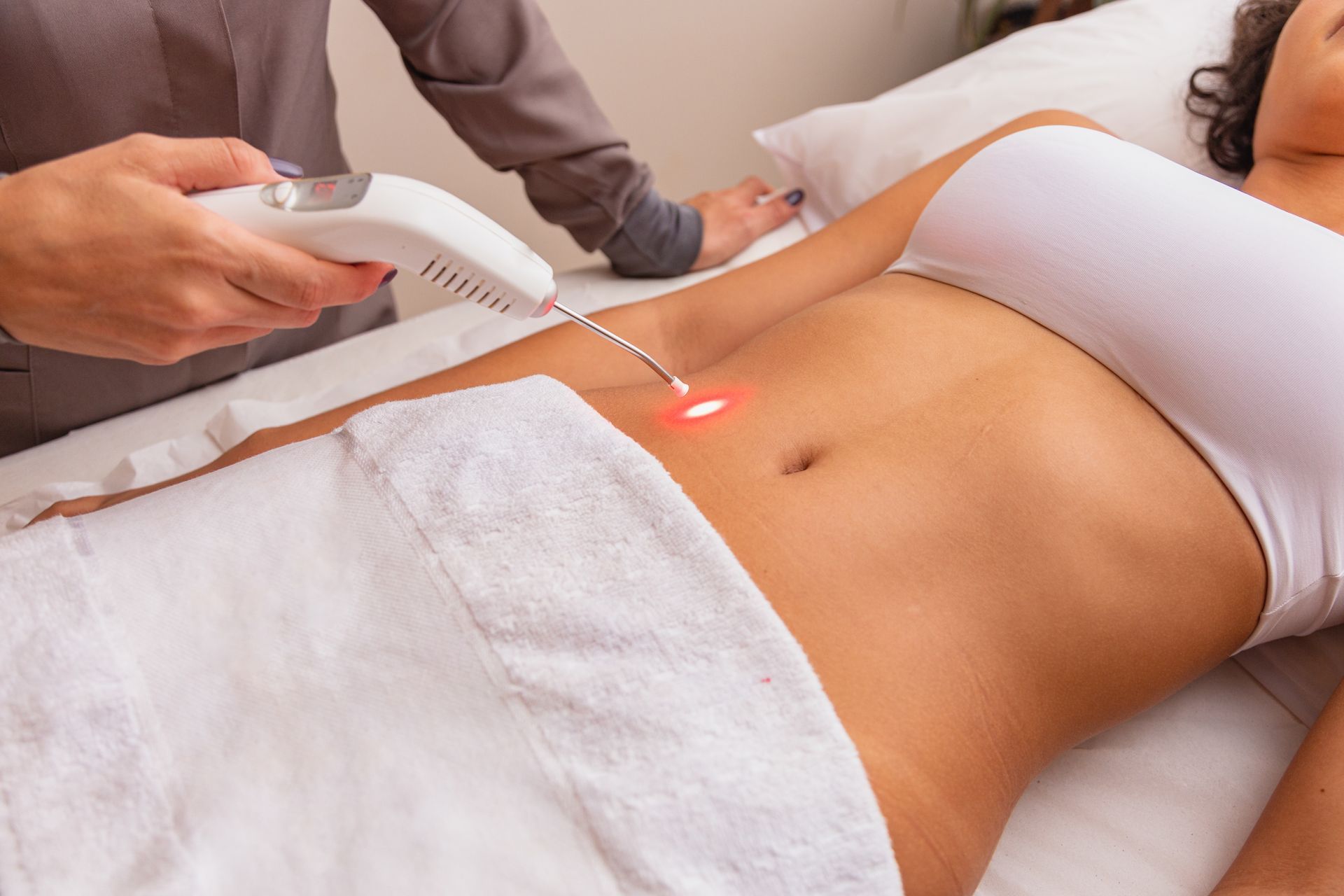 laser Hair Removal