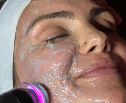 Advanced Glo2Facial treatment for glowing skin in Boerne, TX