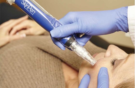 microneedling for acne scars and aging in Boerne, TX