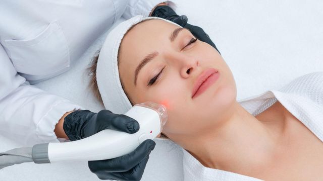 Chemical Peel Treatment