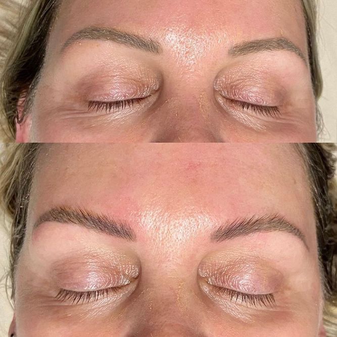 Before and after photos of eyebrows; top photo with faint brows, bottom photo with filled-in brows.