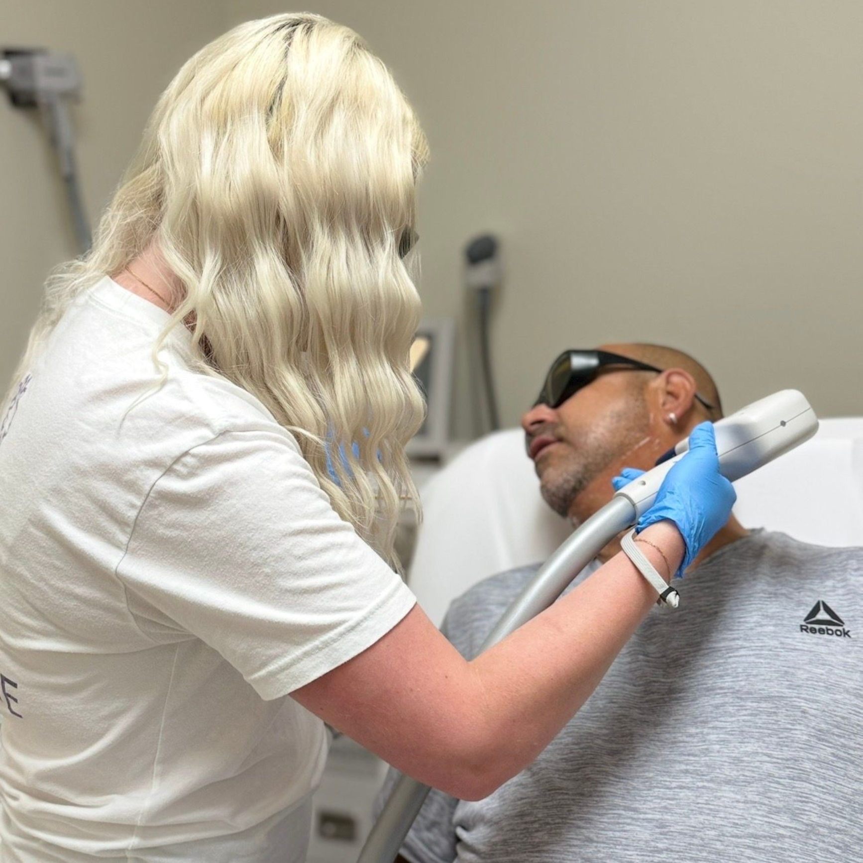 laser hair removal beard line treatment for men