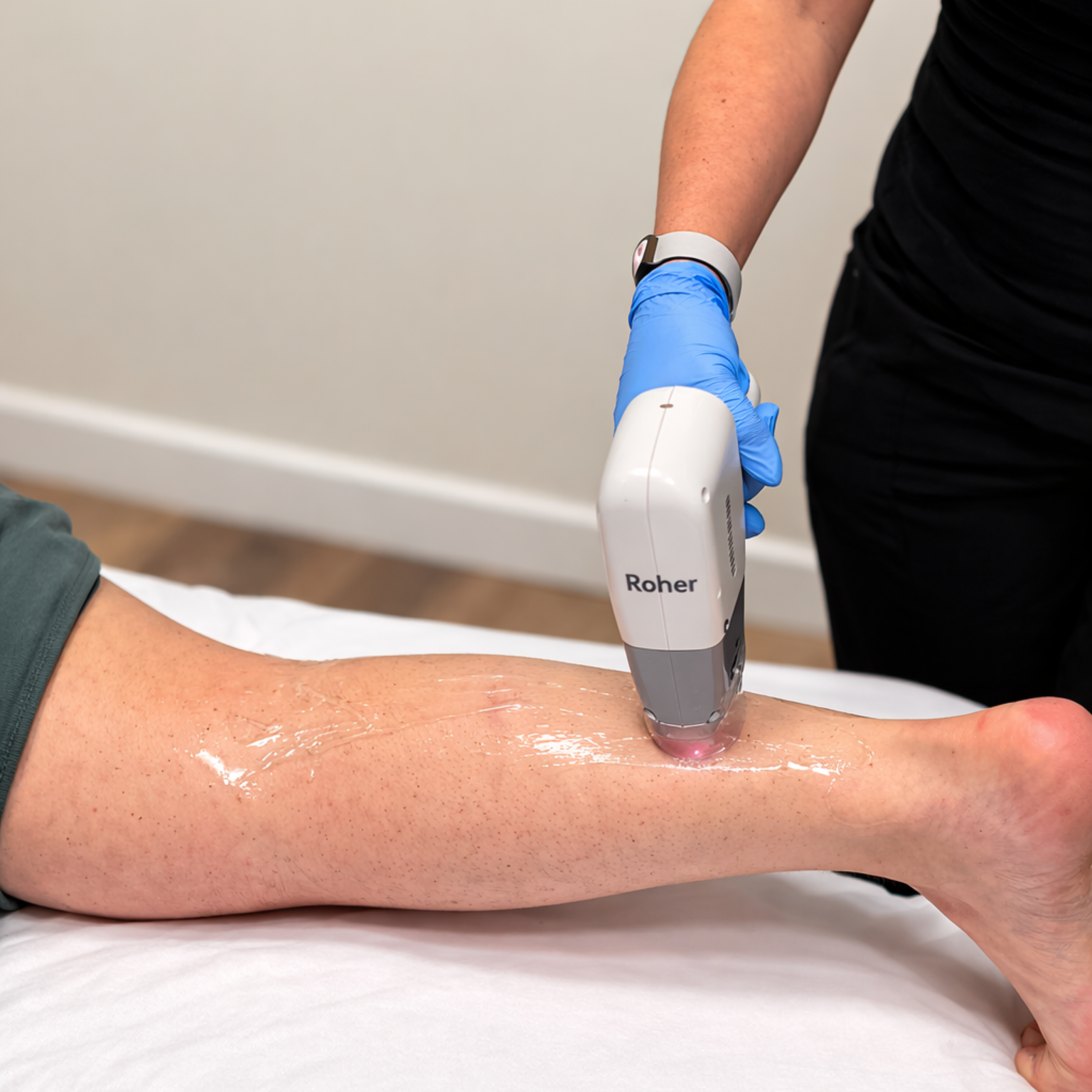 Laser hair removal treatment on the back of the leg at a med spa in West Point, Syracuse, Clinton and Clearfield, Utah