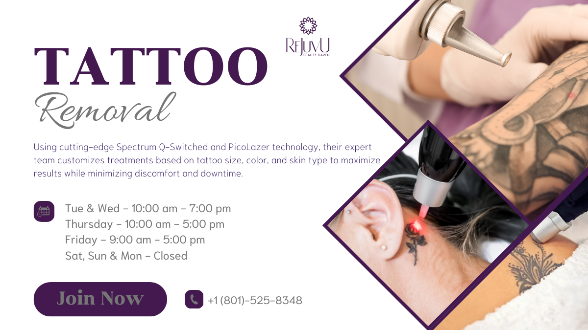 Consultation and patch test for laser tattoo removal at ReJuvU Day Spa, Clinton UT