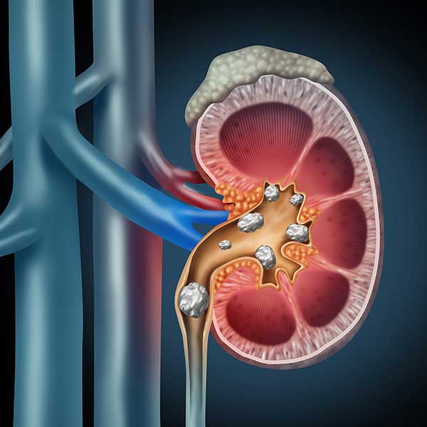 DR. JAVIER S. ALVARADO DORIA - Infertilidad masculina