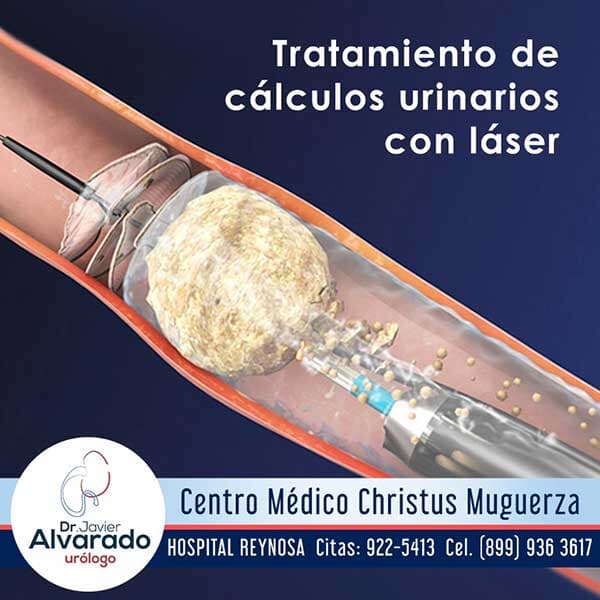 DR. JAVIER S. ALVARADO DORIA - Cirugía mínima invasiva