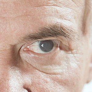 Ophthalmology — Man With Glaucoma in Georgia, VT