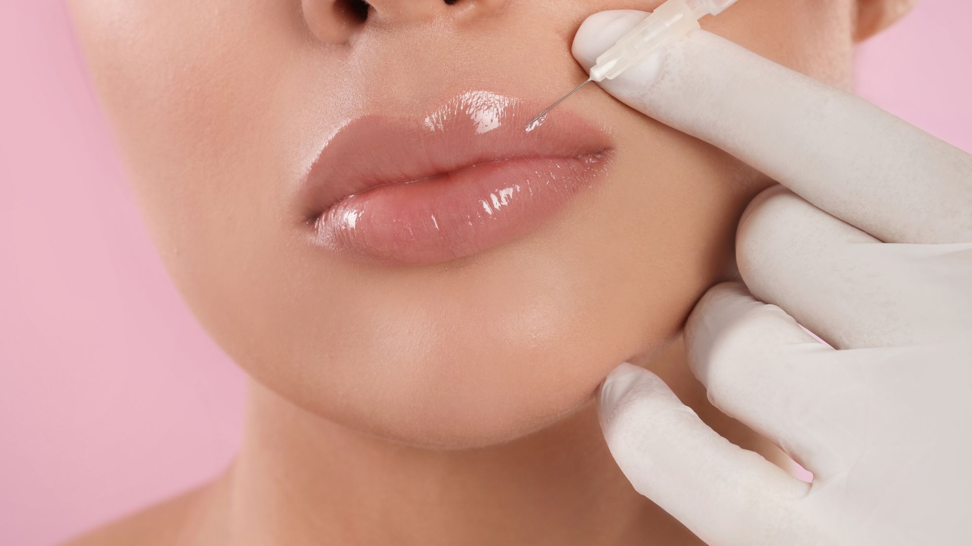 Achieve your desired lip volume and shape with our professional lip filler services, expertly administered in Grayson, GA.