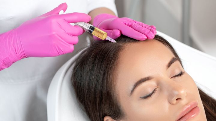 A woman is getting a botox injection in her head. PRP Hair Restoration