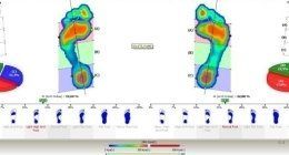radiografia di piedi paziente