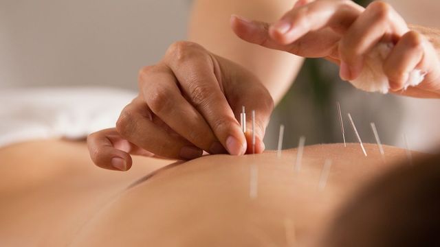 Un professionista inserisce aghi da agopuntura nella schiena di un paziente.