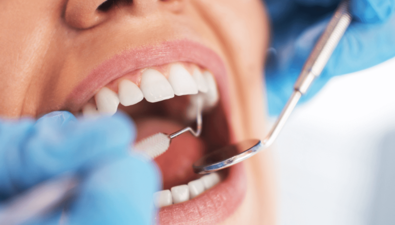 Estetinis protezavimas ir plombavimas
