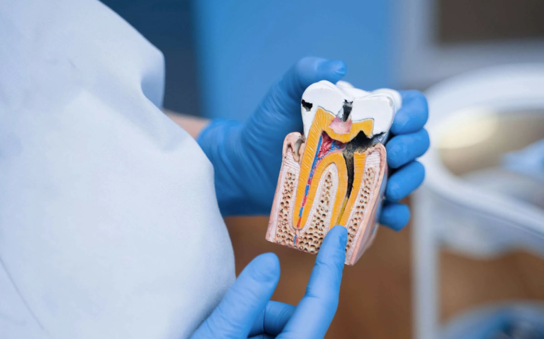 Endodontinis gydymas
