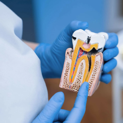 Endodontinis gydymas