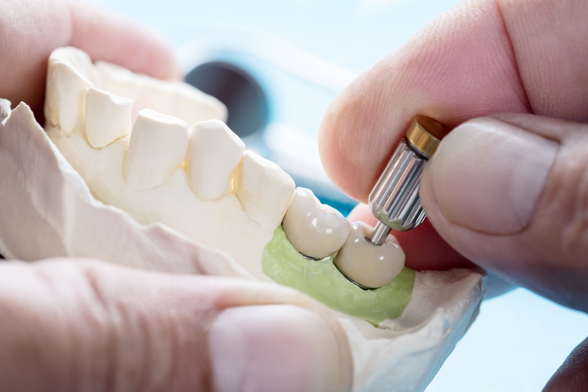 Dental Abutment Laboratory in Sedgwick County, KS