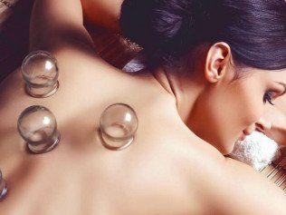 woman receiving cupping treatment