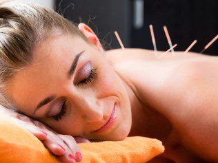 woman receiving dry needling acupuncture