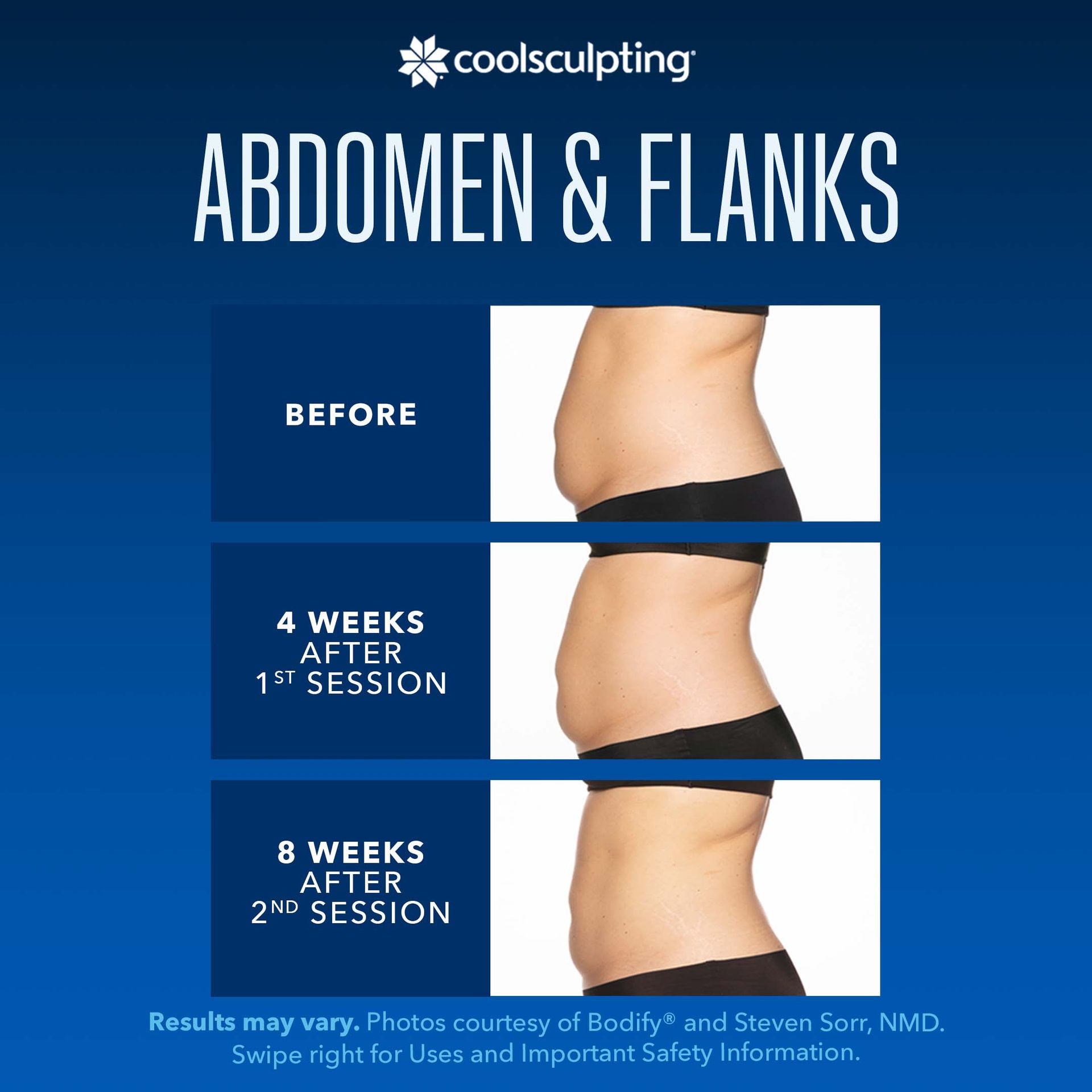 a before and after picture of a woman's abdomen and flanks for coolsculpting treatment