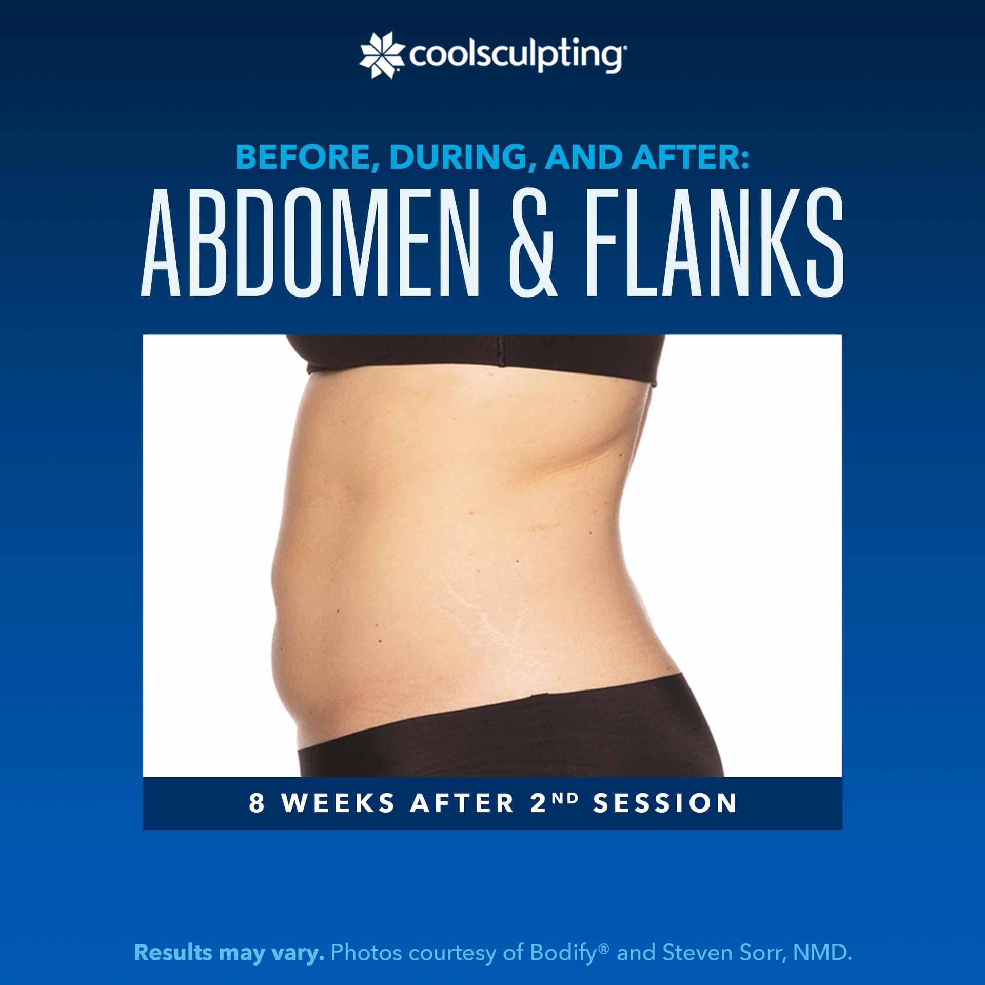a before and after picture of a woman's abdomen and flanks for coolsculpting treatment