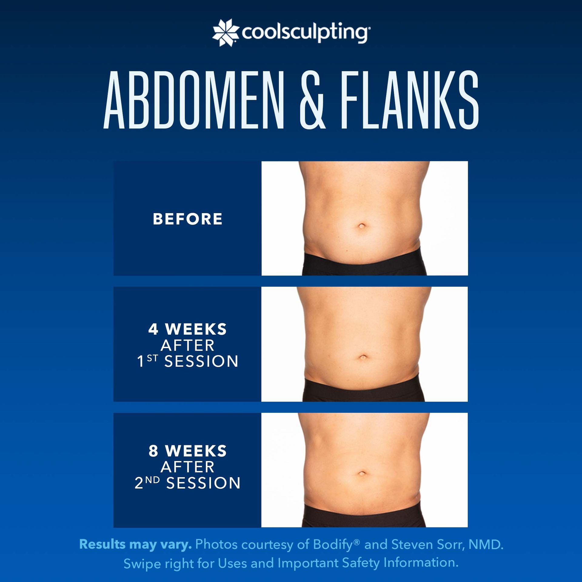 a before and after picture of a man's abdomen and flanks for coolsculpting treatment