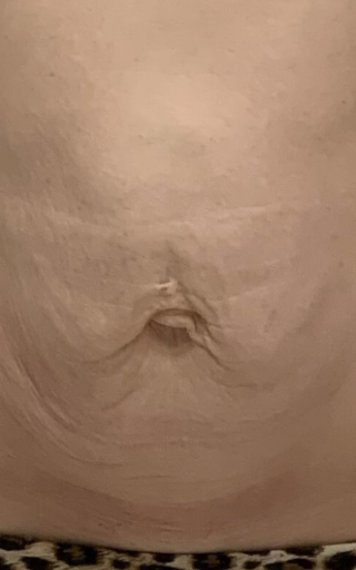 a close up of a woman's stomach with a belly button piercing