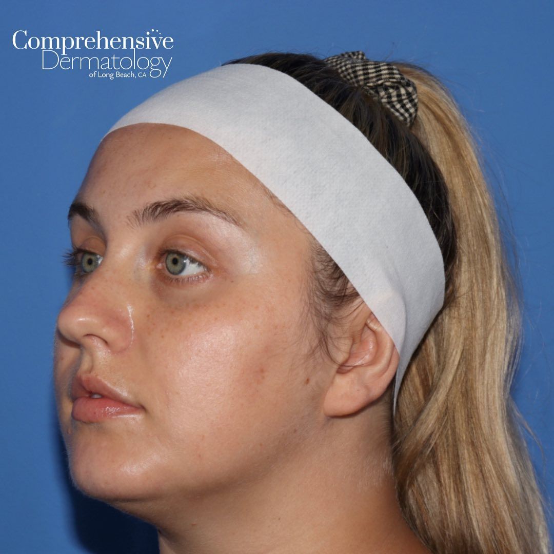 a woman wearing a headband facing 3/4 right with the word comprehensive on it