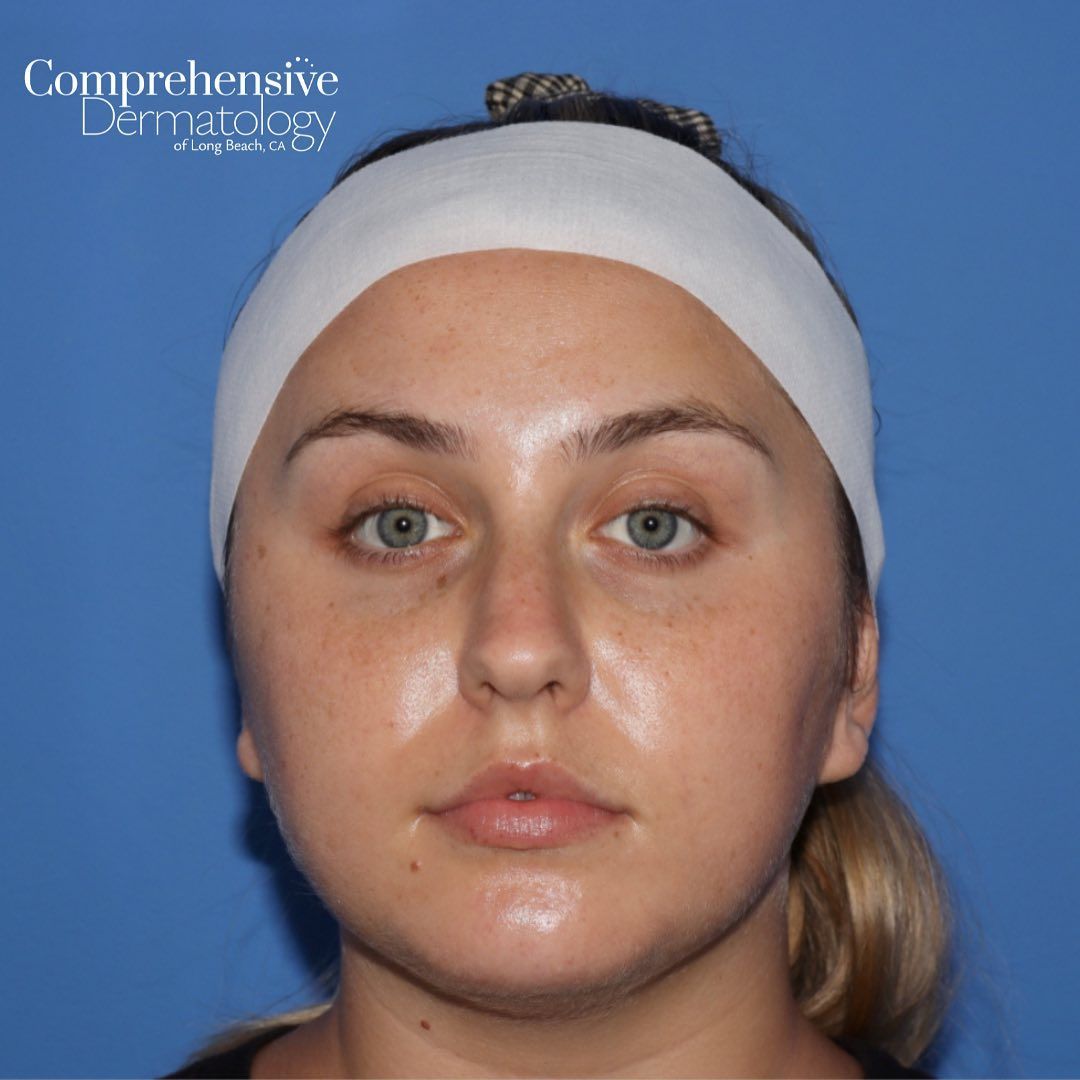 a woman wearing a headband facing front with the words comprehensive dermatology on it