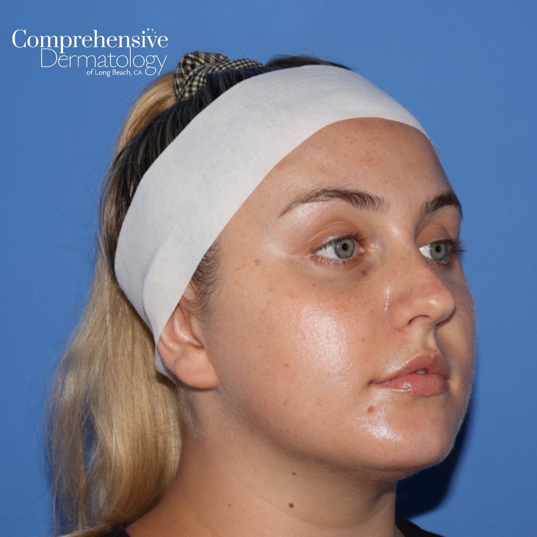 a woman wearing a headband faceing 3/4 left with the word comprehensive on it