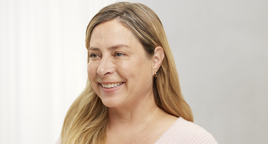 a woman in a pink shirt is smiling and left before Botox treatment