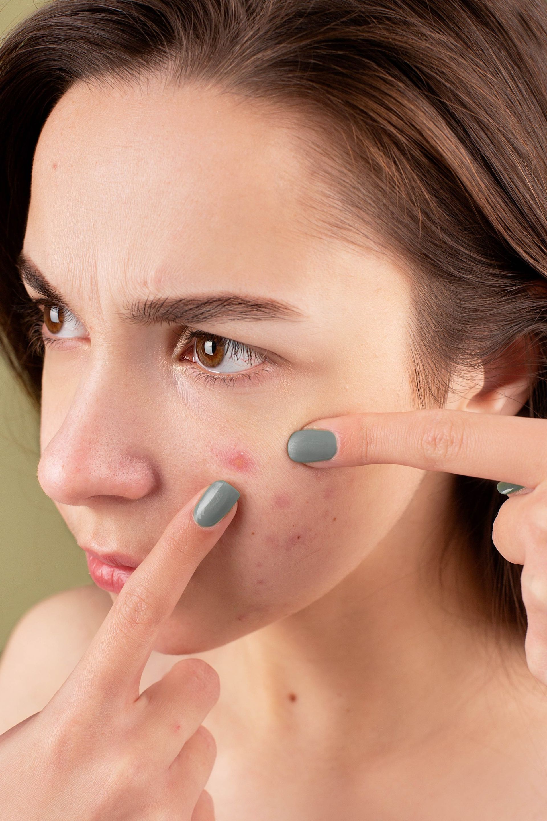 close up photo of a womans face with both her fingers about to pop a pimple on her cheek.