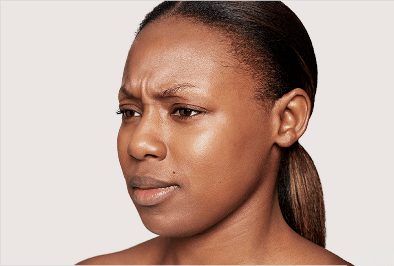 a close up of a woman's face frowning before Dysport treatment