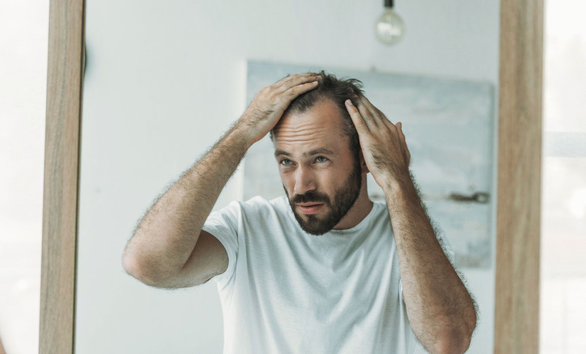 man examining his receding hairline in front of the mirror
