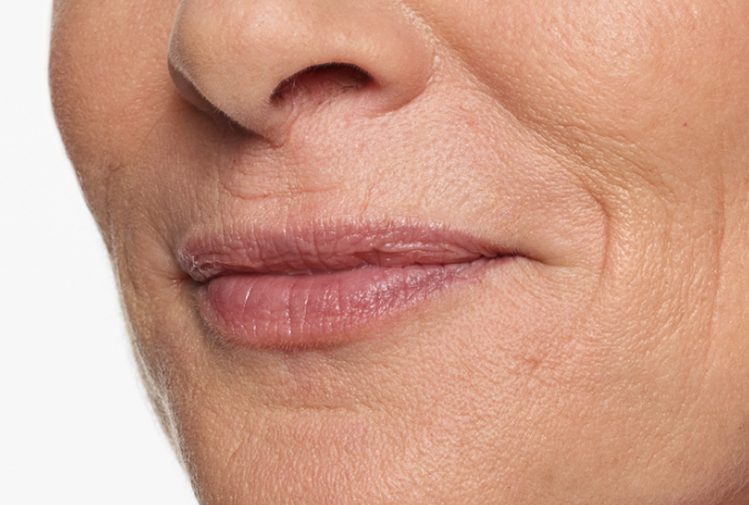 a close up shot of a woman 's bottom half  face with wrinkles on her lips before demal fillers