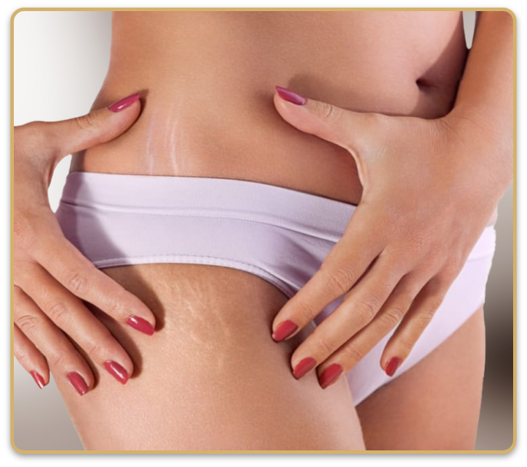 Eine Frau mit roten Nägeln hält ihre Hände auf ihrem Bauch