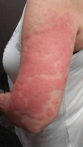 Netelroos - Kompas Geert Franssen