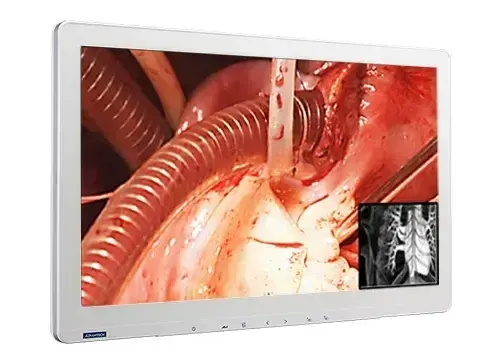 Advantech's PAX-327 surgical monitor