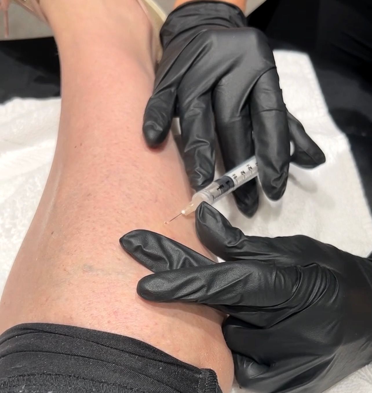 botox injection winnipeg