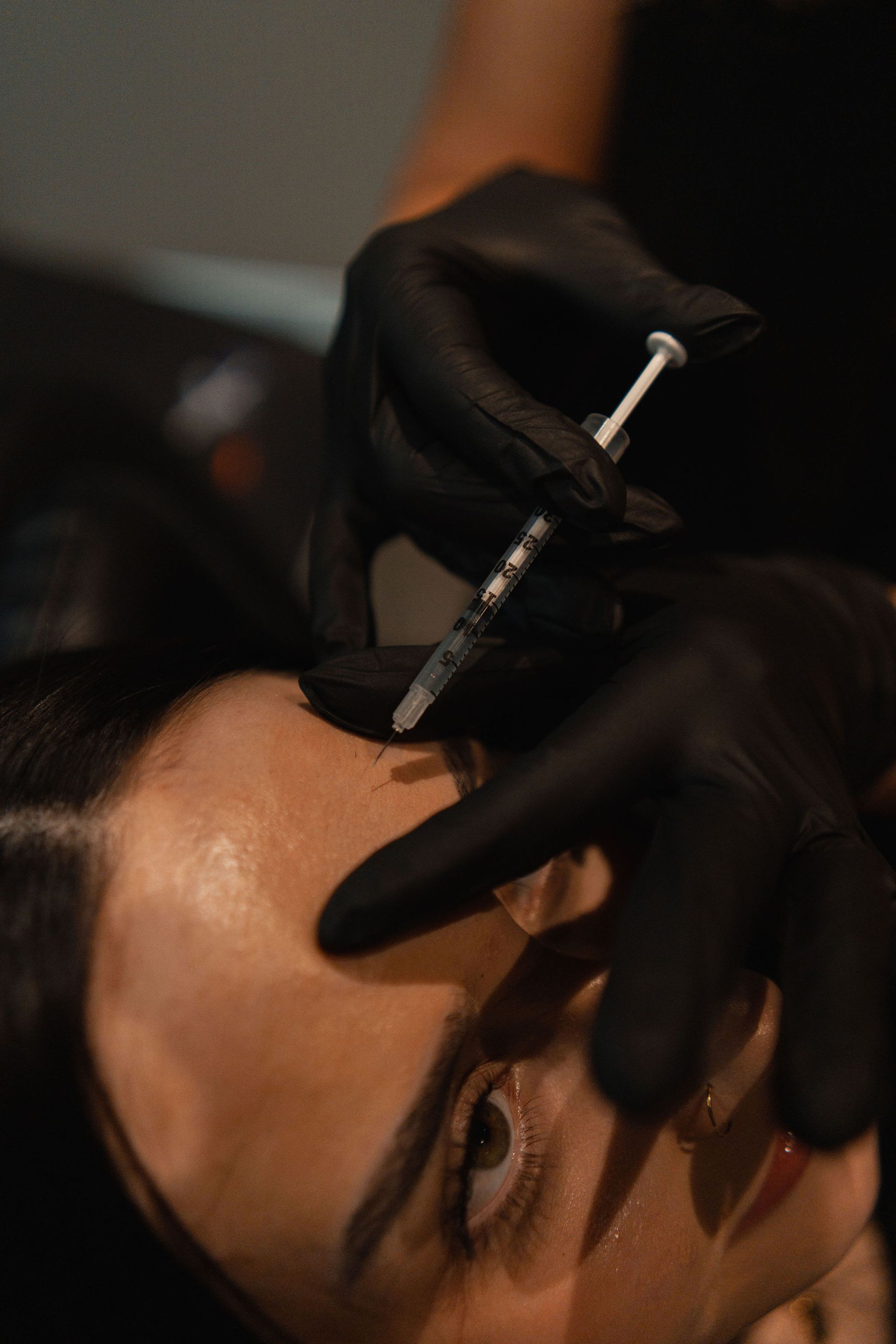 Person receiving a facial injection. Gloved hands holding syringe near forehead.