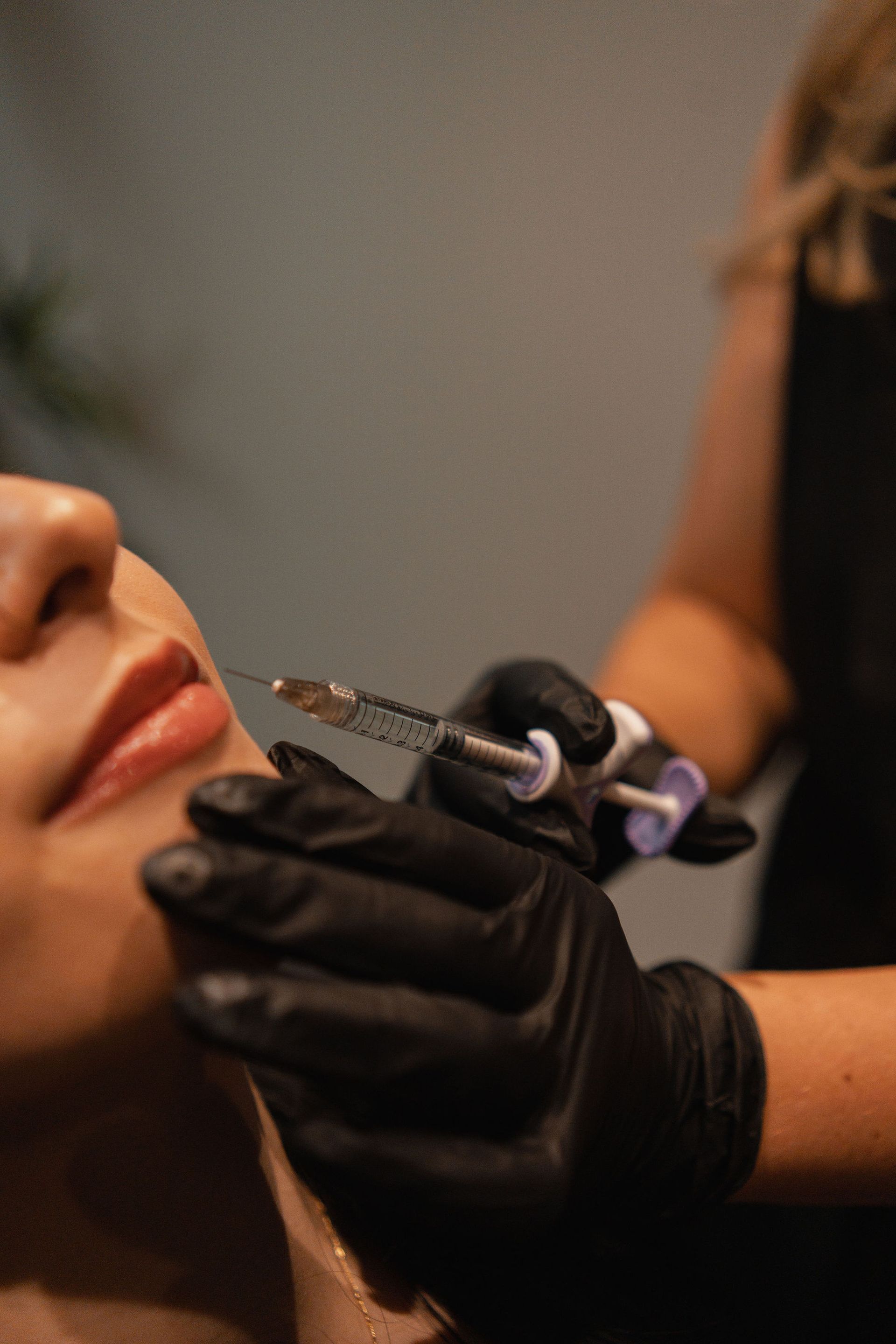 Person receiving lip filler injection from a gloved hand.