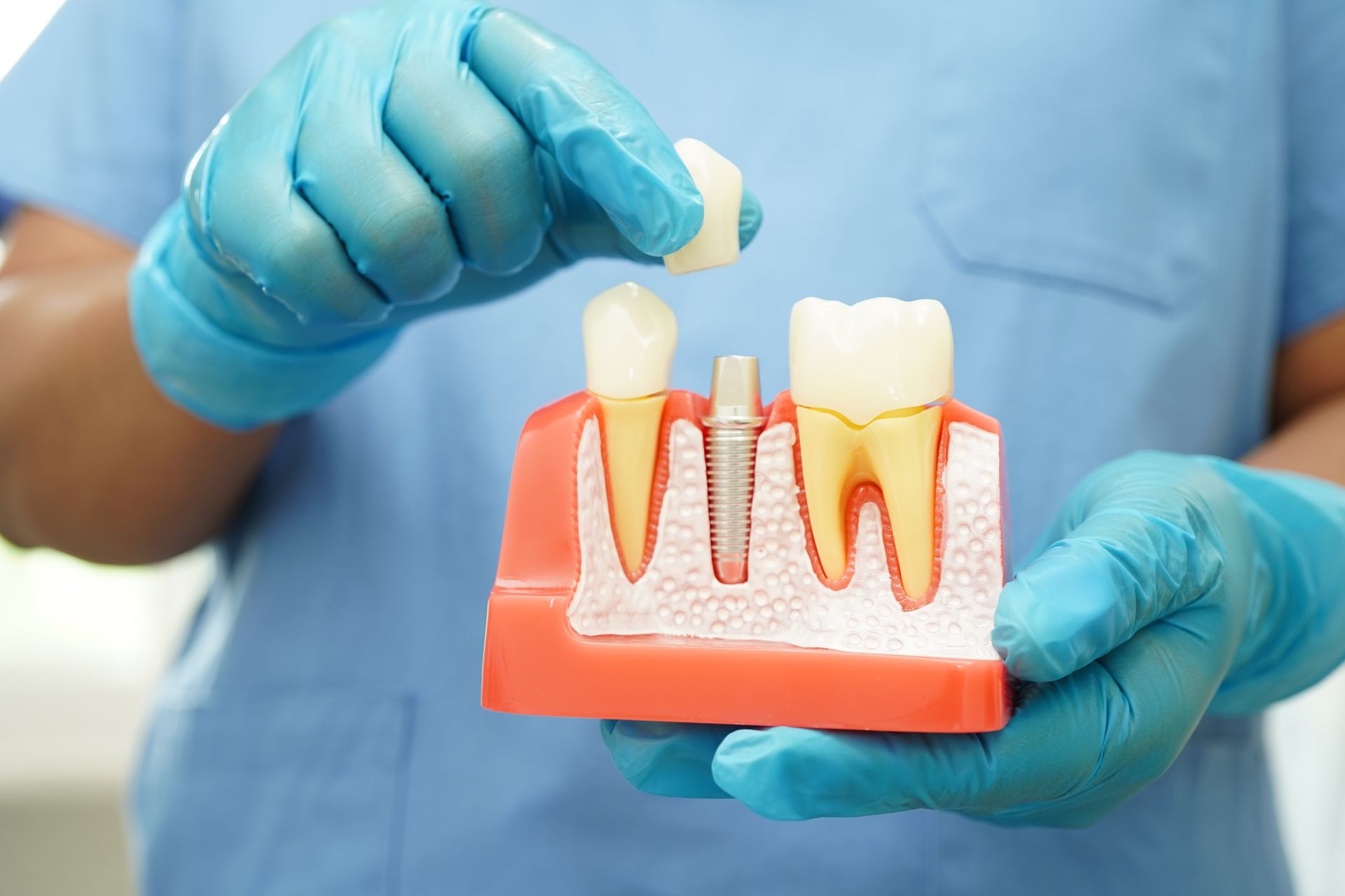 Dentist holding dental implant model, demonstrating placement of a crown.